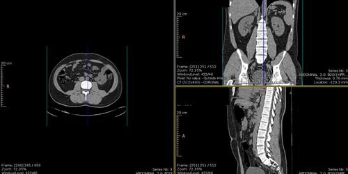 Accediendo al Sergas y a eSaude desde linux
