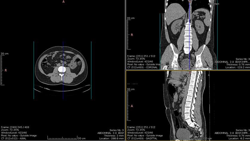 Accediendo al Sergas y a eSaude desde linux